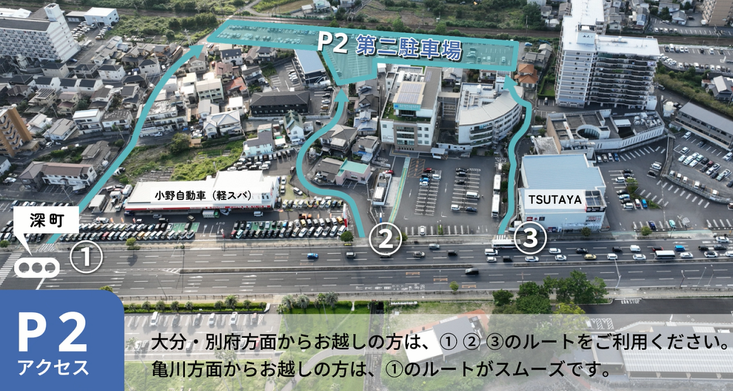 バナー画像:第二駐車場までの道順